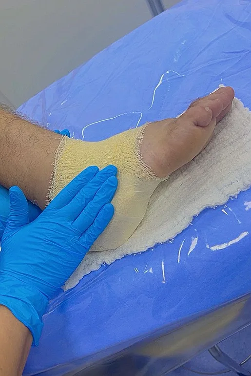 HSC inicia atendimentos do ambulatório de feridas crônicas